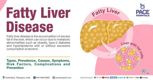 10 Tips For Preventing Fatty Liver